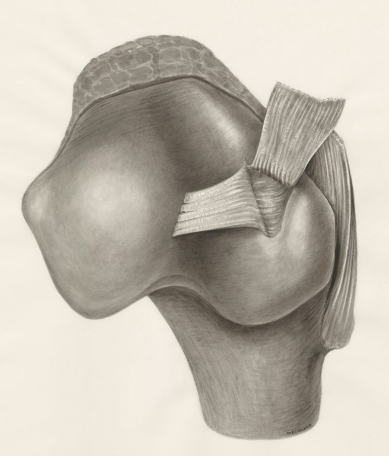 knee joint pain at 40 and arthritis