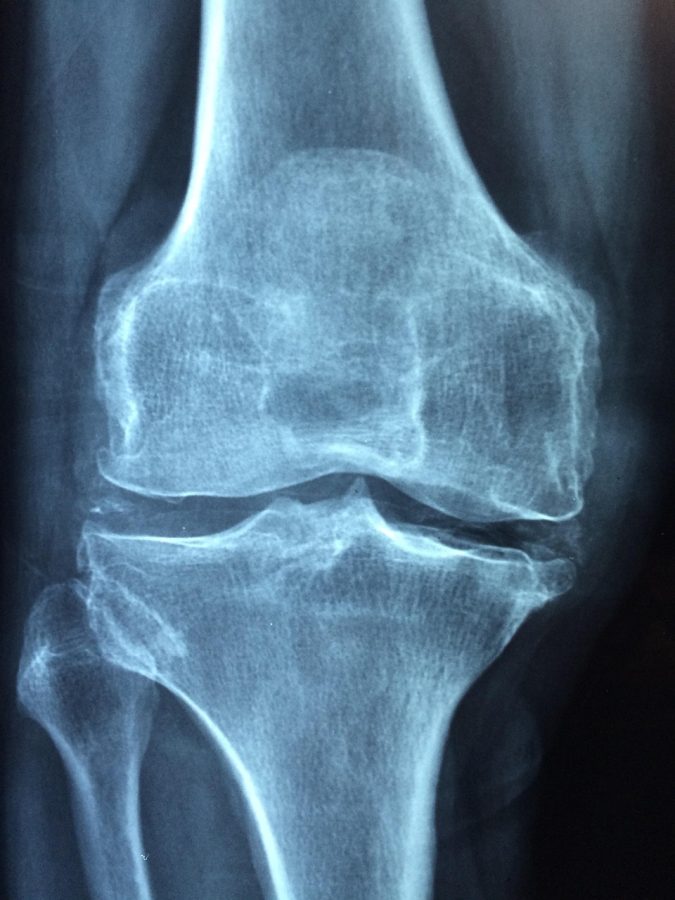 knee 1406964 1280
